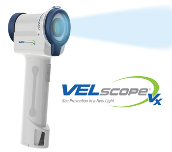 image of velscope 