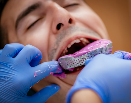 man getting a dental impression done